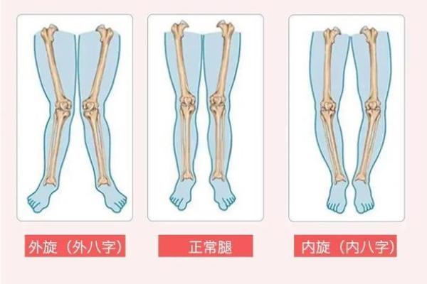 外八字性格 外八字性格